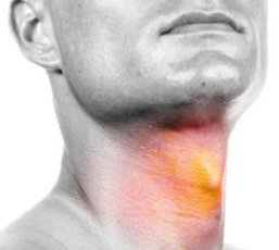 лечение рака гортани в израиле