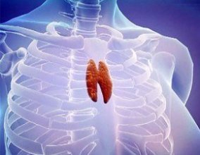 опухоль вилочковой железы