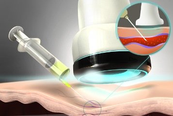 лечение заболеваний вен 