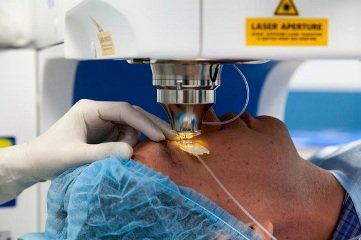 Лазерная коррекция зрения в Израиле