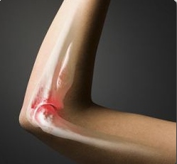 онкологические эндопротезы 