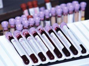 Стволовые клетки Роды израиль