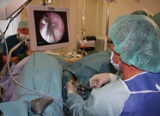 трансуретральная резекция мочевого пузыря