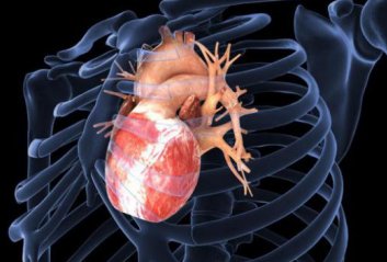 гипертрофированное сердце