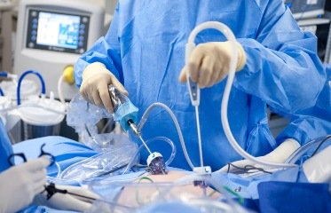 Лапароскопия при ГЭРБ