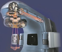 Лечение рака груди (молочной железы) в Израиле